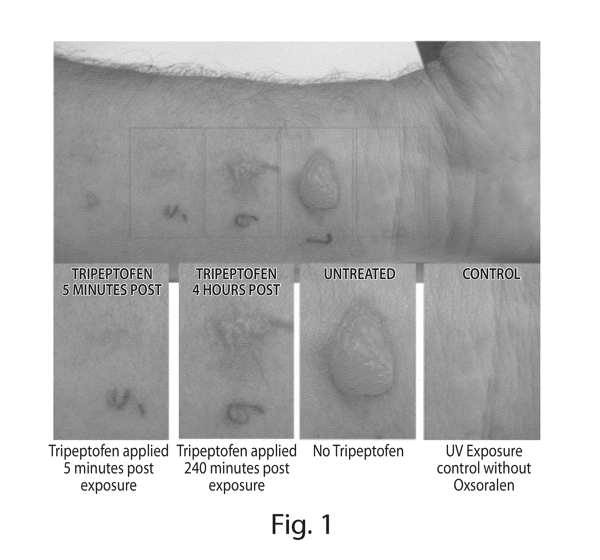 Tissue disruption treatment and composition for use thereof