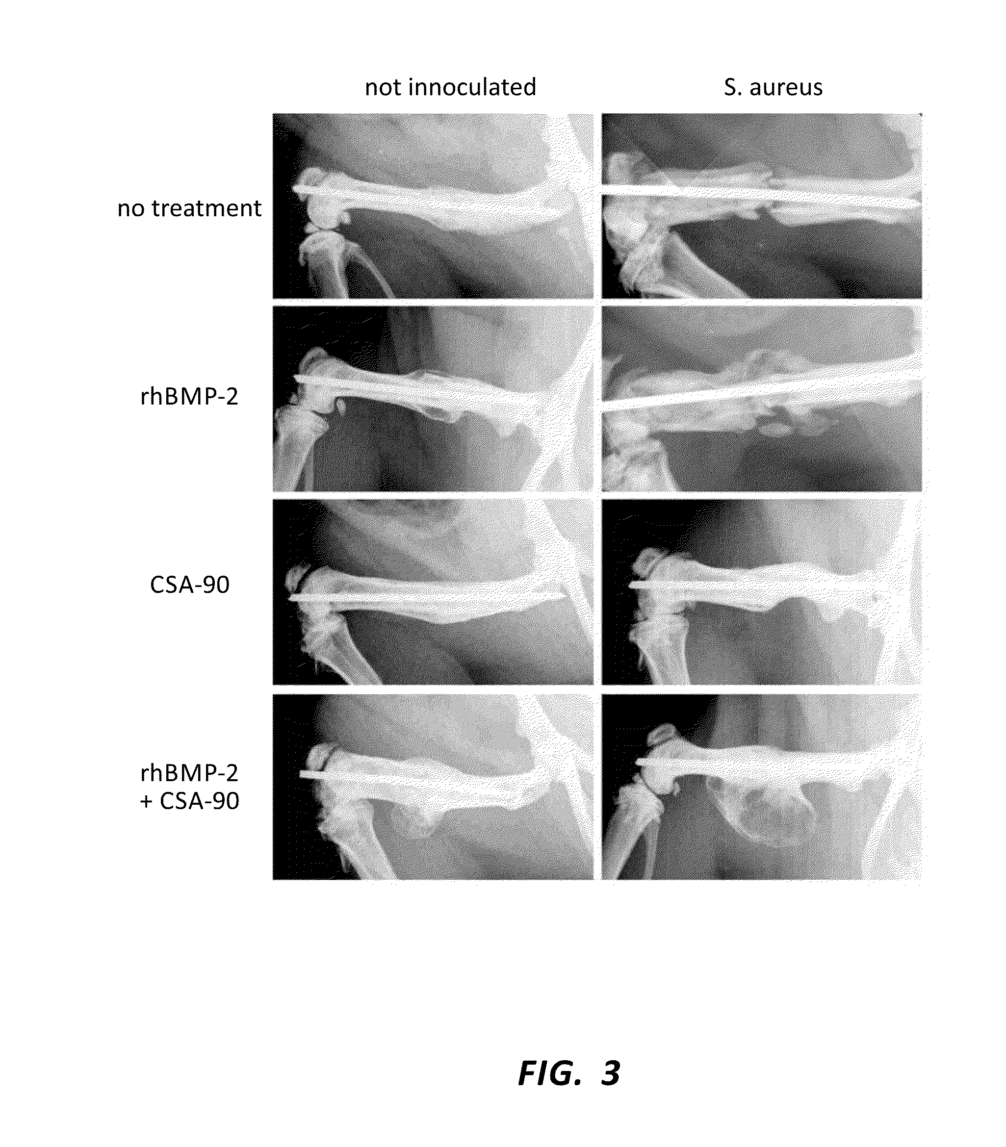 Anti-infective and osteogenic compositions and methods of use