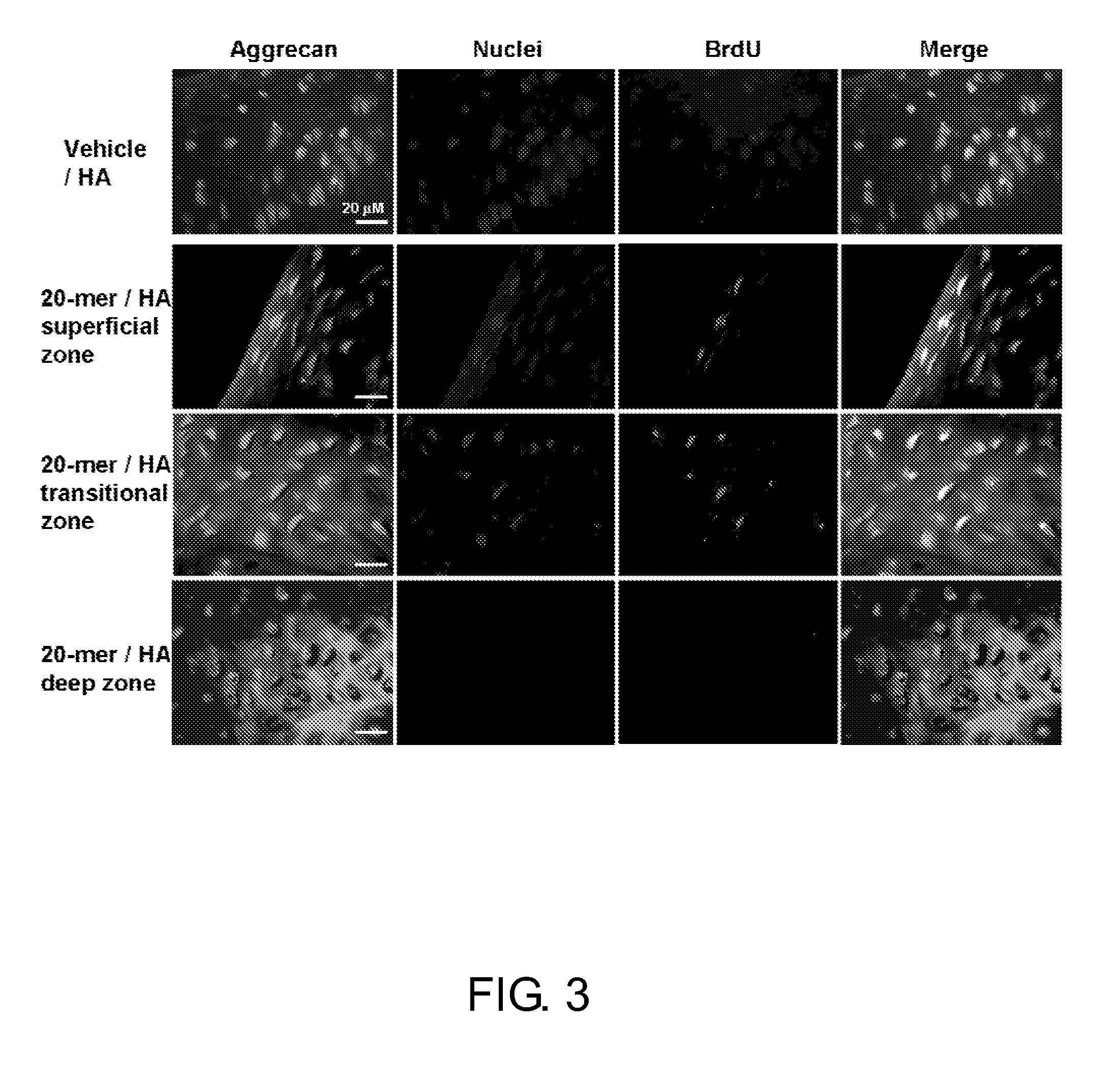 Use of pedf-derived polypeptides for treating osteoarthritis