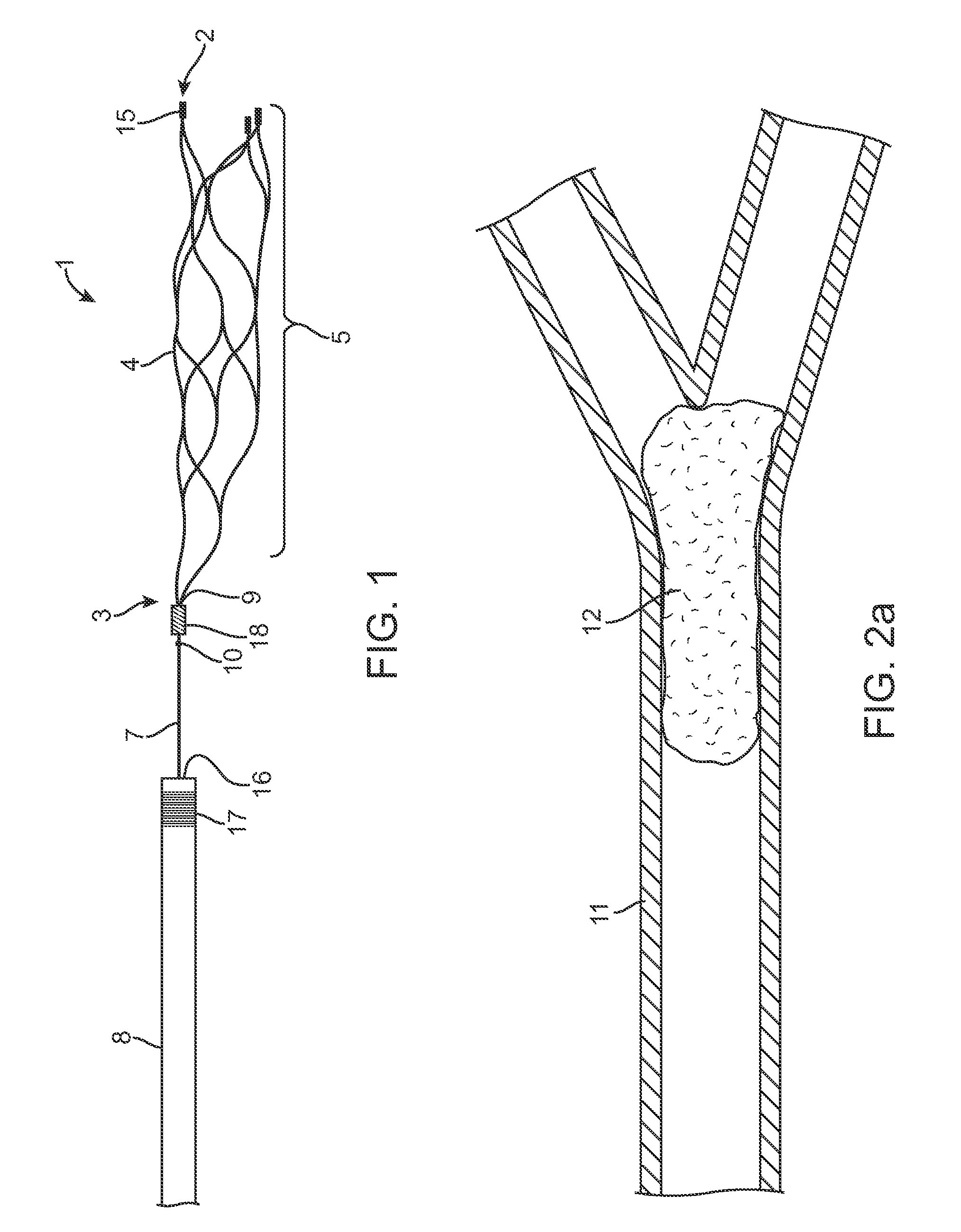 Methods and apparatus for flow restoration