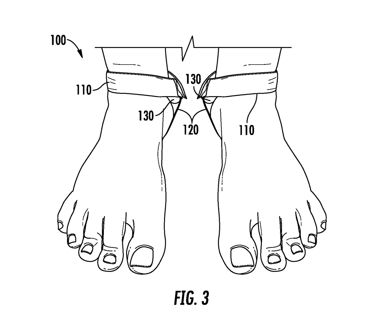 Acupressure therapeutic foot band for and method of menstrual pain relief
