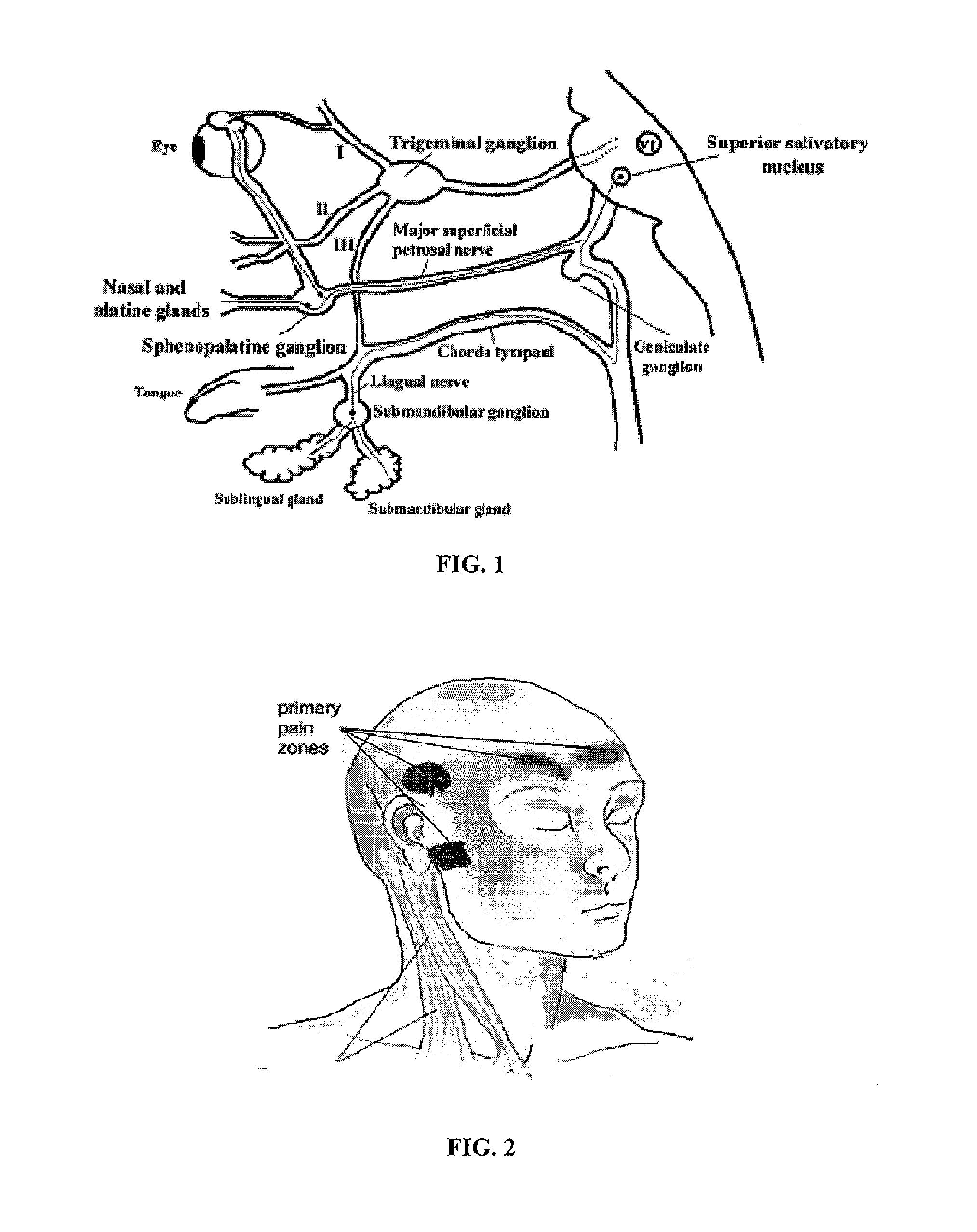 Methods and compositions for treating and preventing trigeminal autonomic cephalgias, migraine, and vascular conditions
