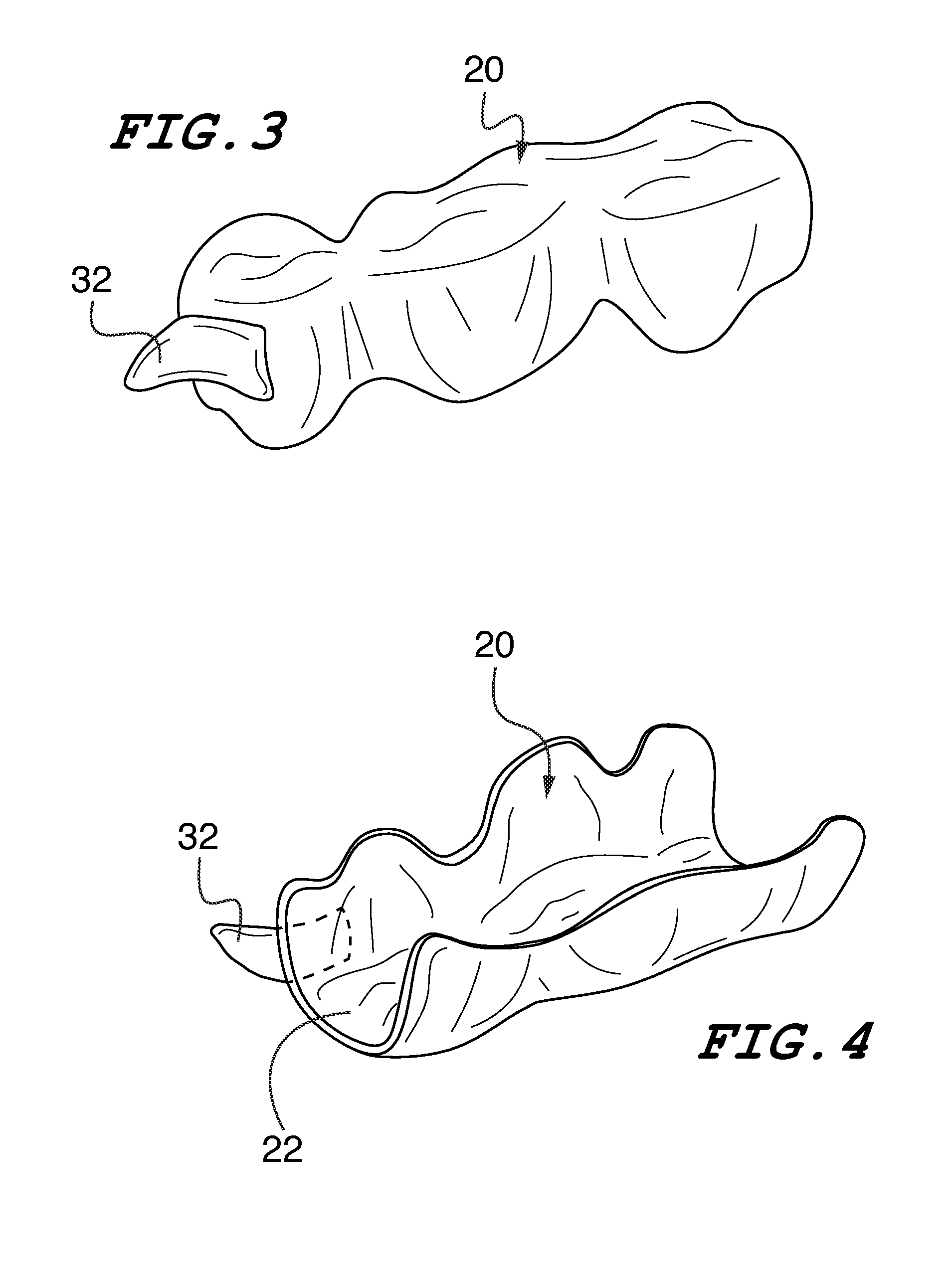 Orthodontic indirect bonding tray including stabilization features
