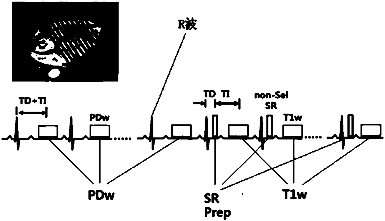 T1 parameter diagram imaging method and magnetic resonance imaging system