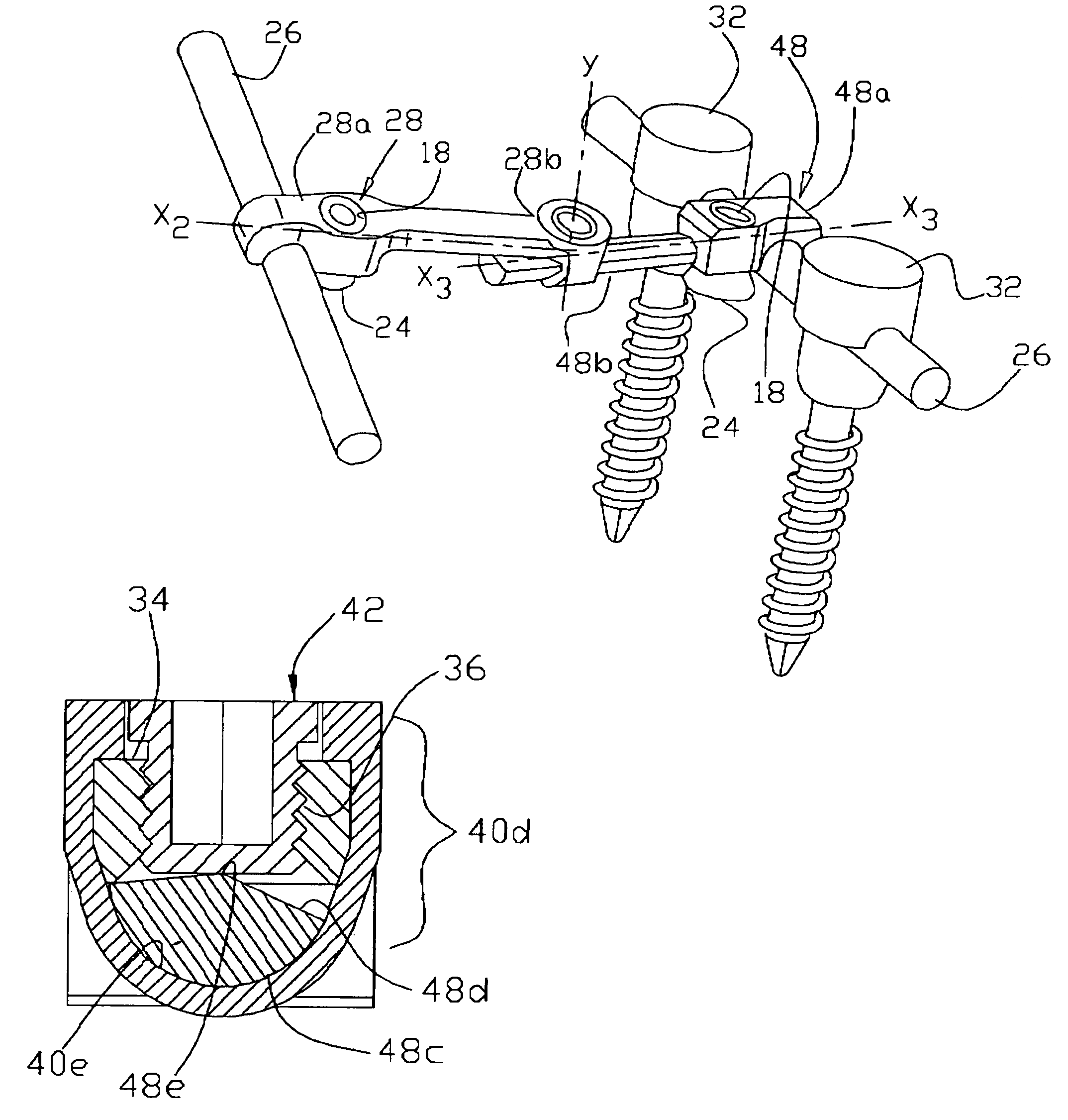 Transverse connector system