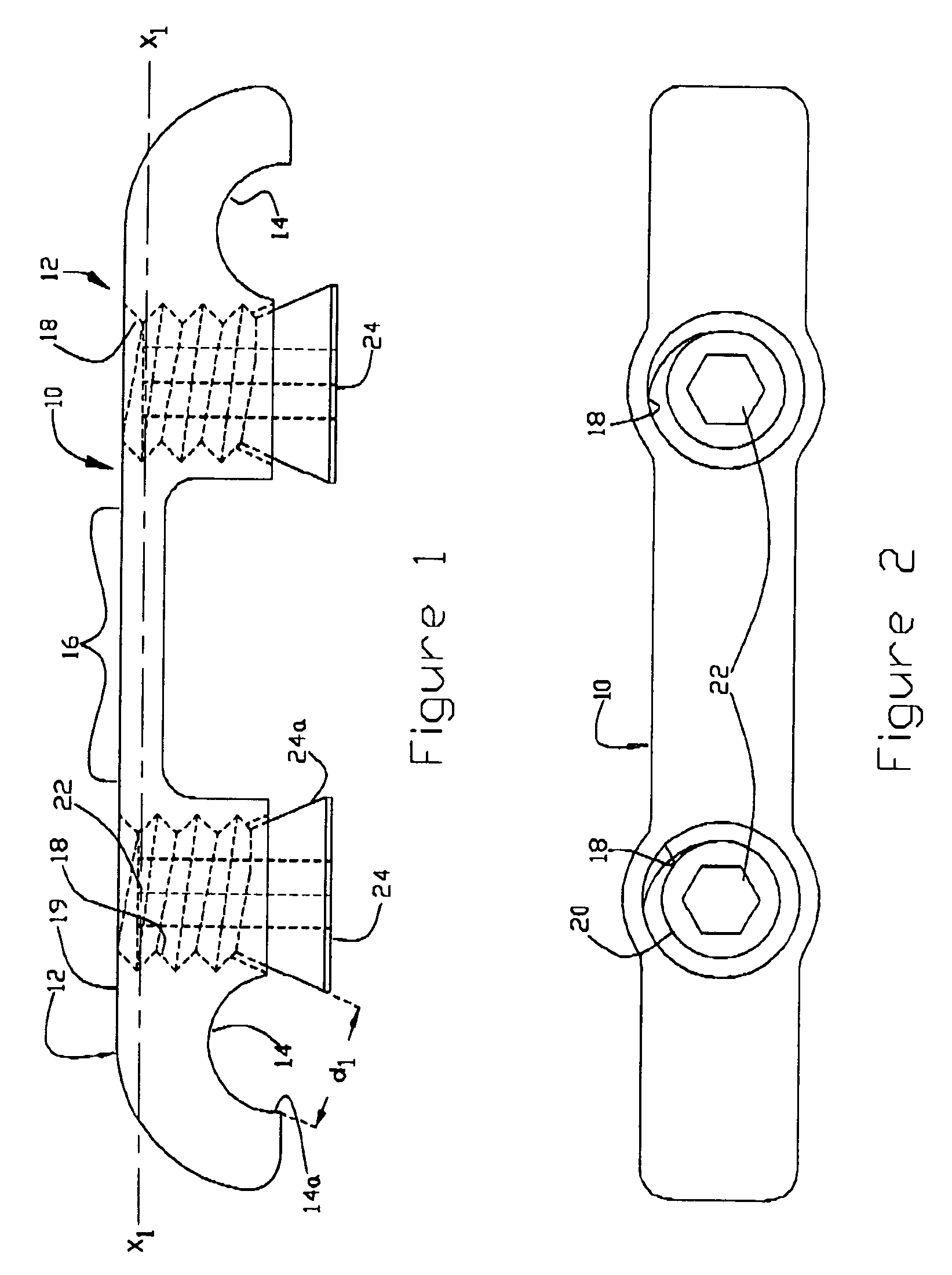 Transverse connector system