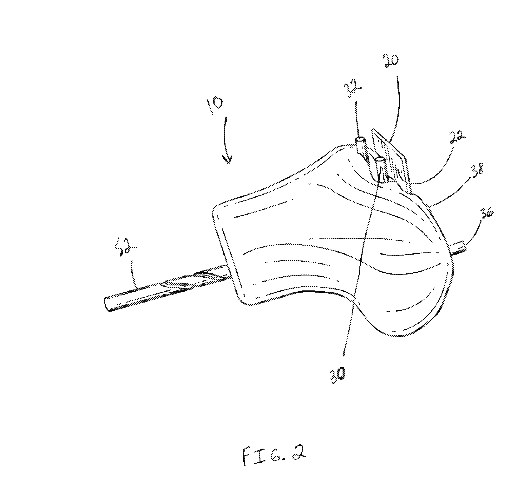 Methods for manufacturing custom cutting guides in orthopedic applications