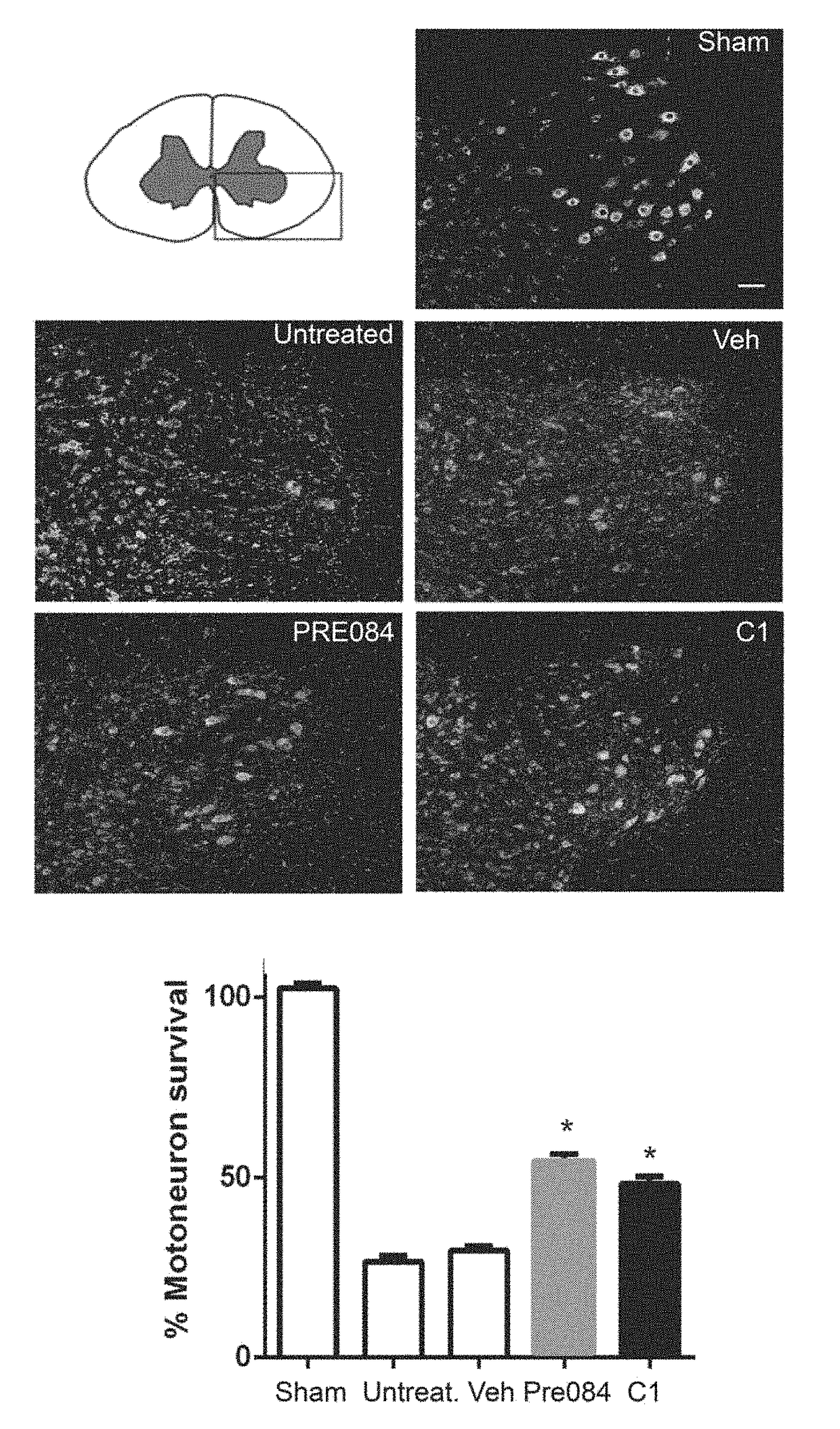 New combination therapies for treating neurological damage