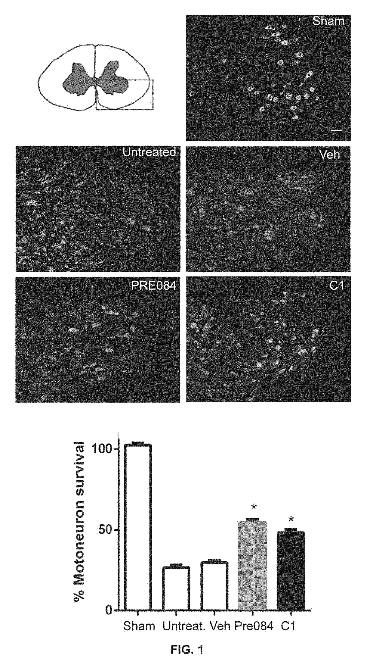 New combination therapies for treating neurological damage