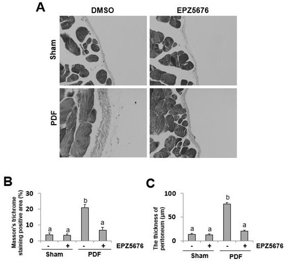 Application of inhibitor of histone methyltransferase DOT1L in preparation of medicine for preventing and treating peritoneal fibrosis after peritoneal dialysis