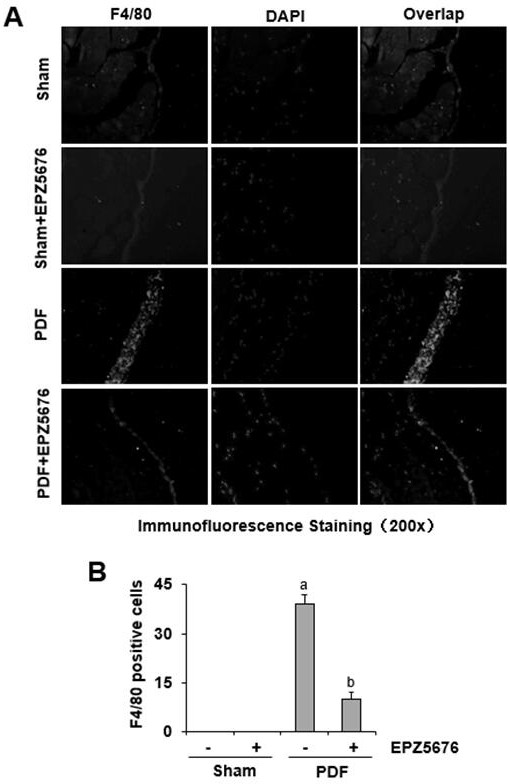 Application of inhibitor of histone methyltransferase DOT1L in preparation of medicine for preventing and treating peritoneal fibrosis after peritoneal dialysis