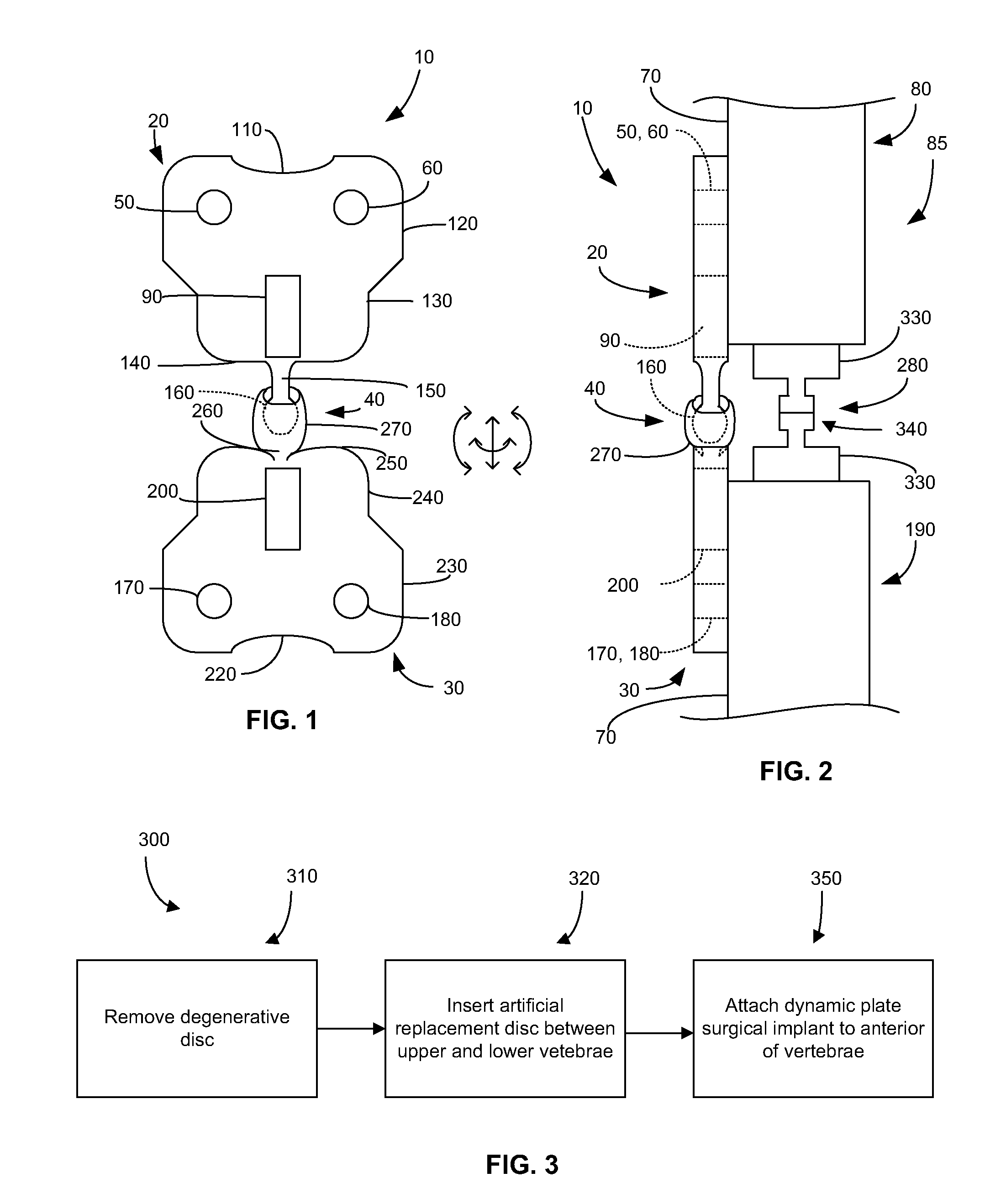 Dynamic Spinal Plate Implant and Method of Use