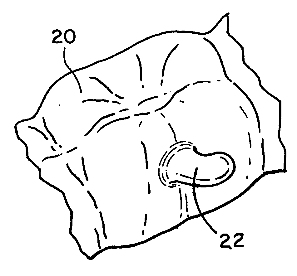 Method for creating features in orthodontic aligners