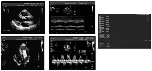 Cardiovascular disease risk prediction and evaluation system combining electronic medical records and medical images