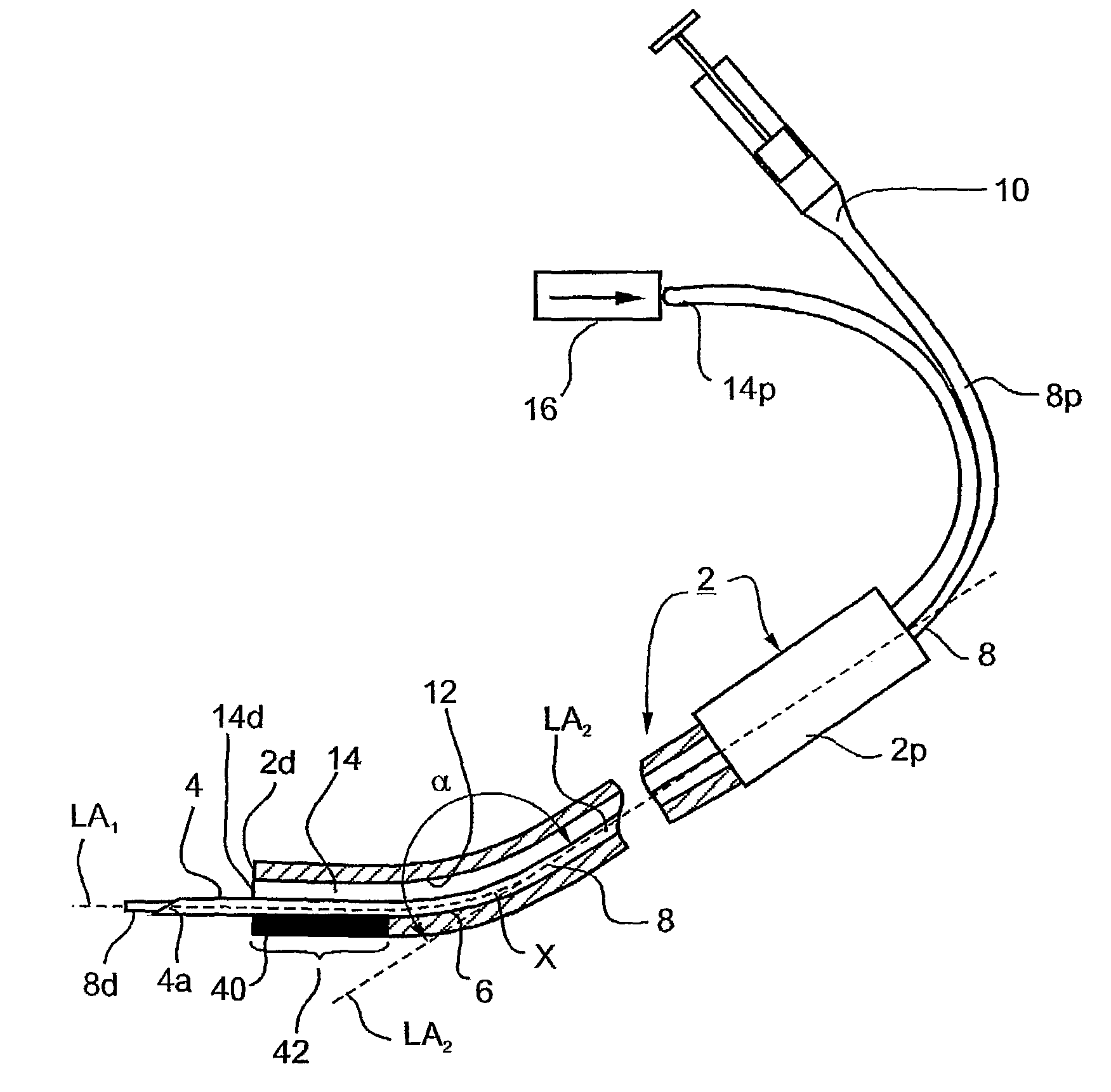 Microsurgical injection and/or distending instruments and surgical method and apparatus utilizing same