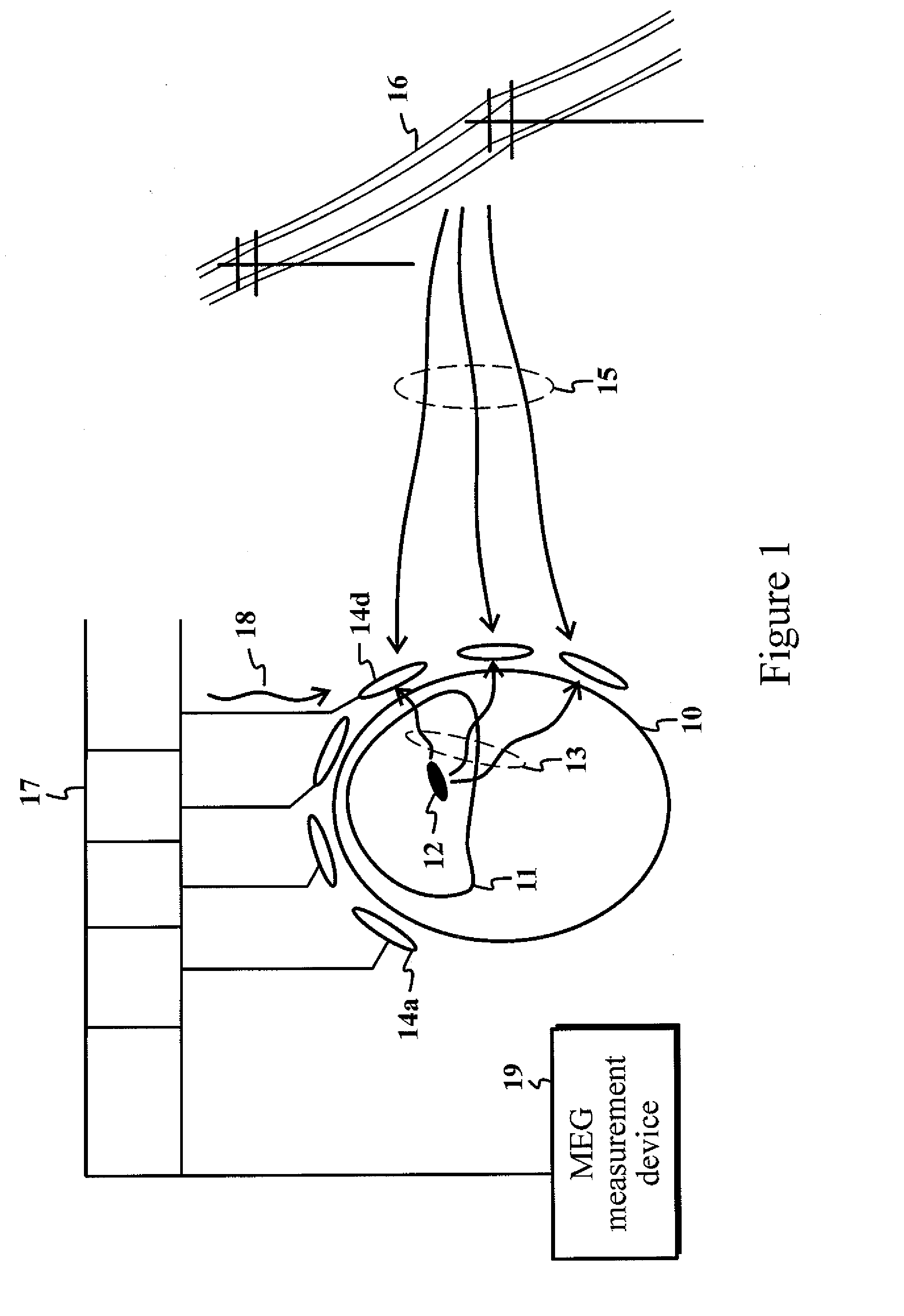Method and device for recognizing and removing undesired artifacts in multichannel magnetic field or electric potential measurements
