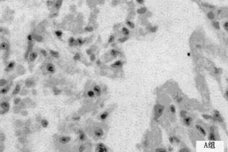 Application of total flavonoids of astragalus in preparing pharmaceutical for preventing and treating acute radiation pneumonitis