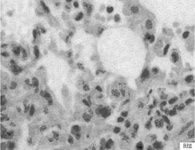 Application of total flavonoids of astragalus in preparing pharmaceutical for preventing and treating acute radiation pneumonitis