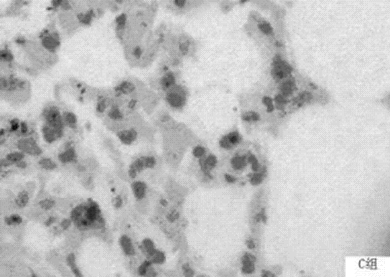 Application of total flavonoids of astragalus in preparing pharmaceutical for preventing and treating acute radiation pneumonitis