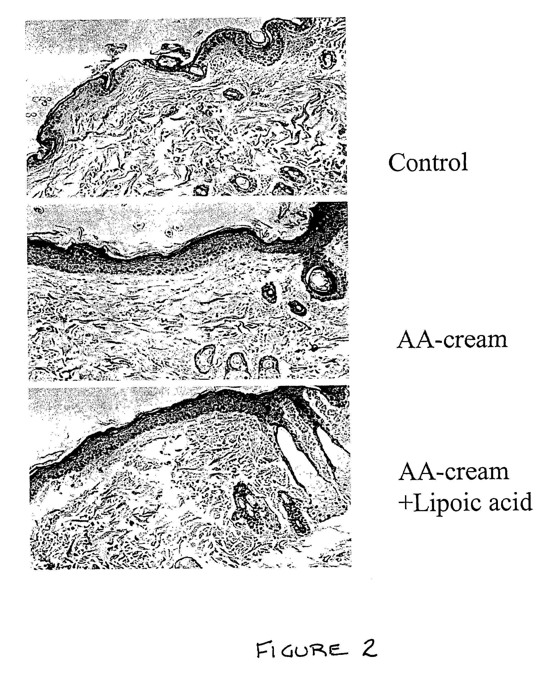 Methods and compositions for enhancing collagen and proteoglycan synthesis in the skin