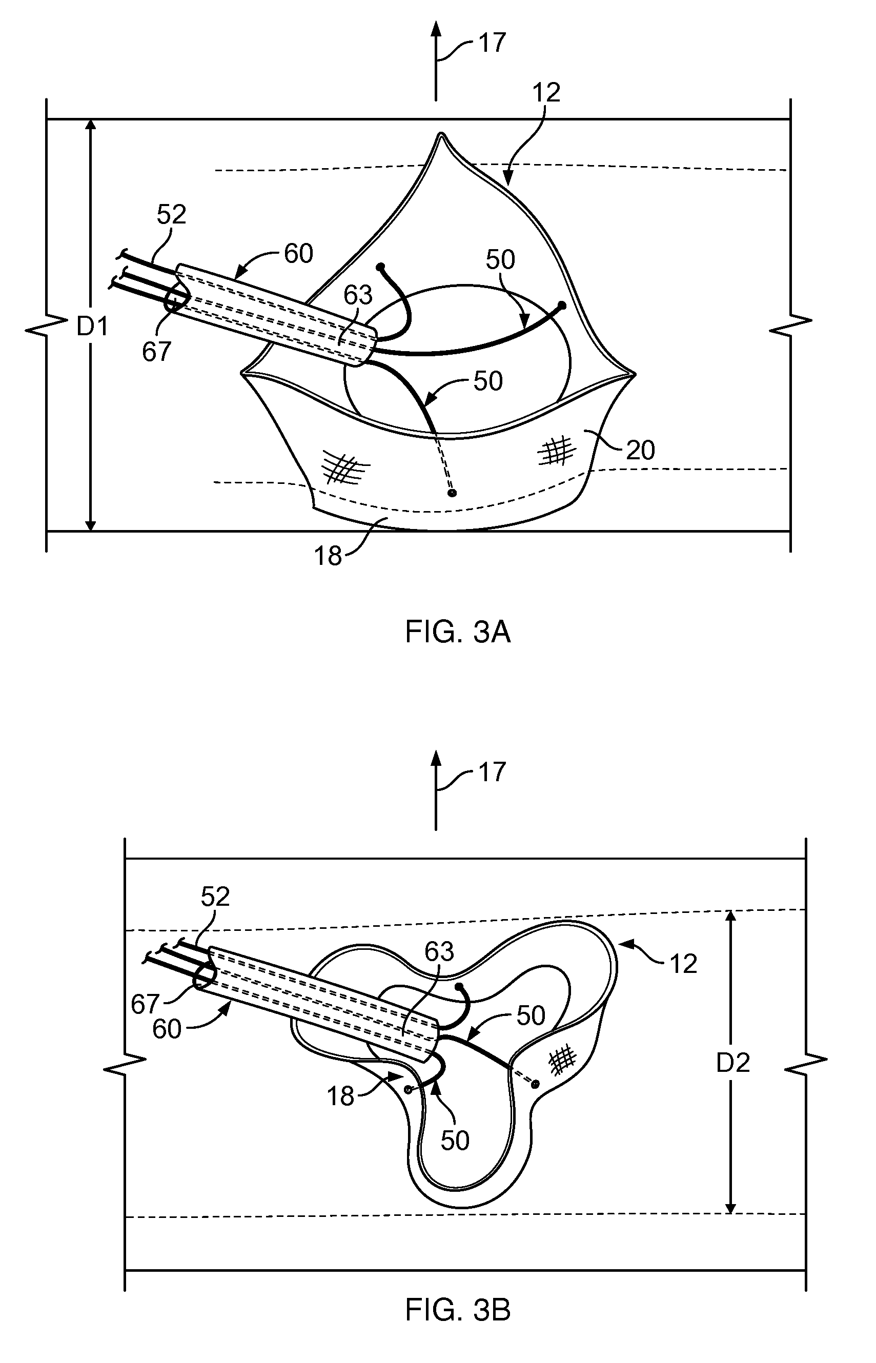 Multiple component prosthetic heart valve assemblies and methods for delivering them
