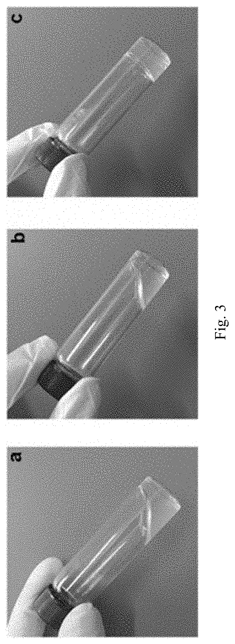 Injectable Temperature-sensitive Composite Hydrogel Containing Adipose-derived Mesenchymal Stem Cells and Preparation Method and Application Thereof