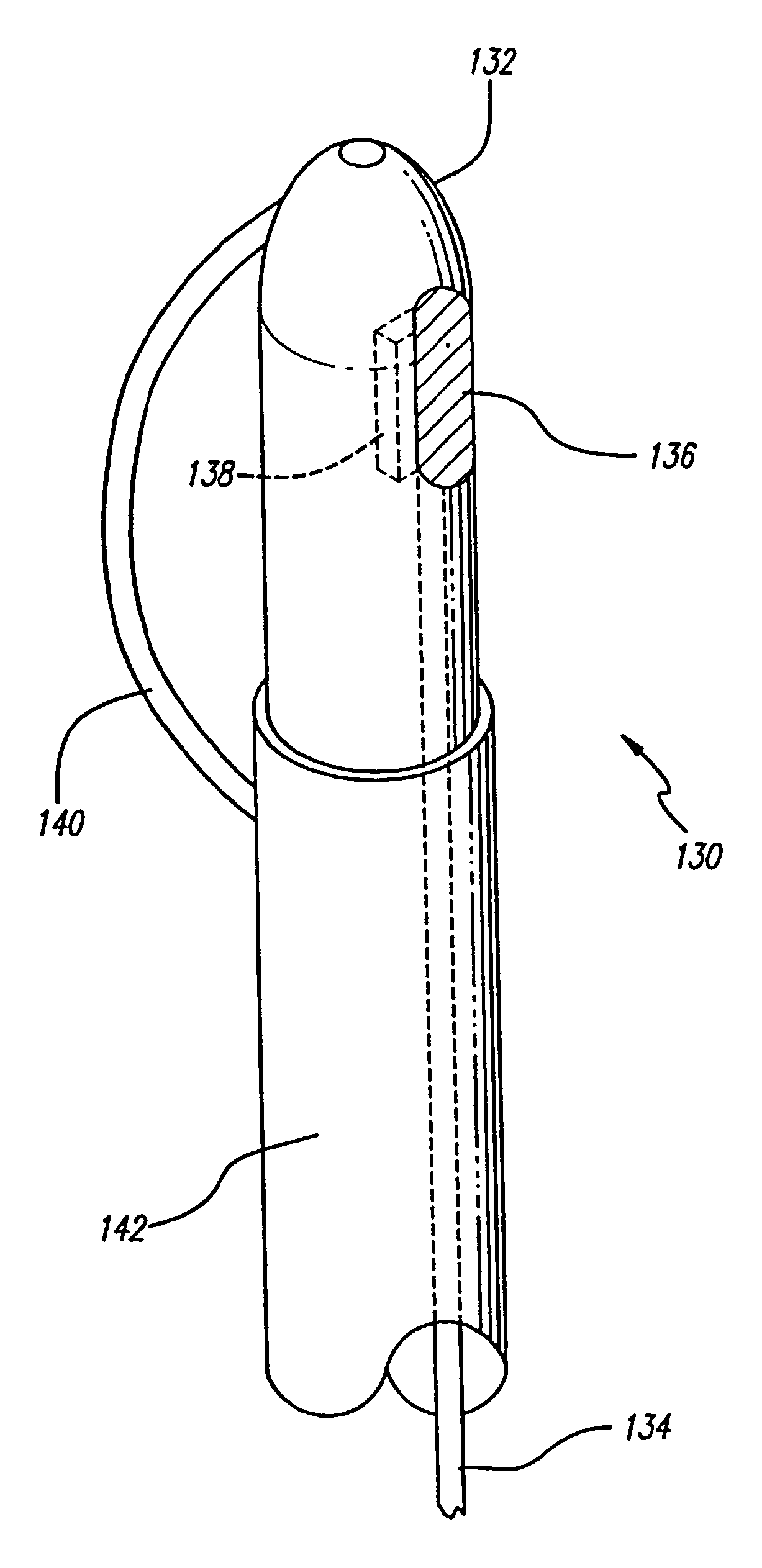 Method and apparatus for treating venous insufficiency using directionally applied energy
