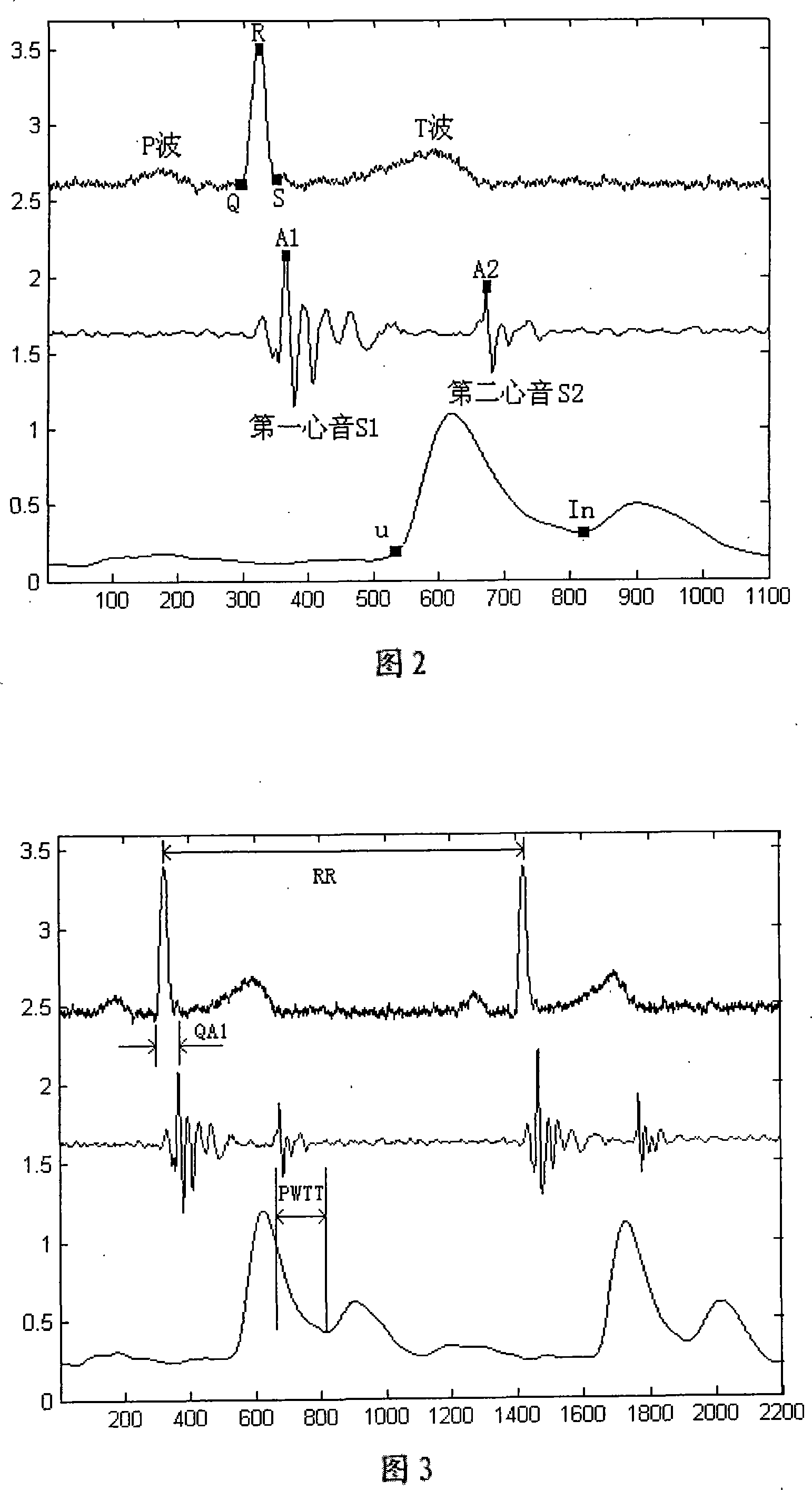 Detector methods and apparatus of cardiovascular system combining with variability guideline