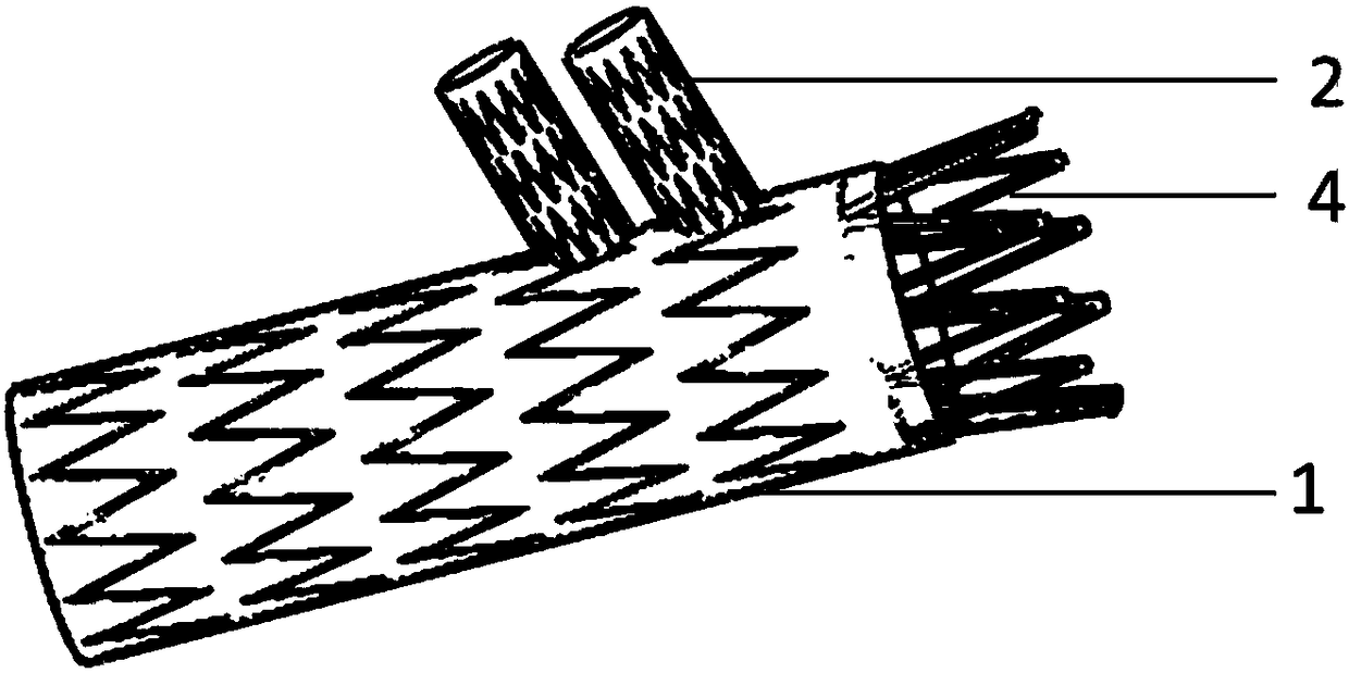 Integrated covered branch vessel stent and its delivery system