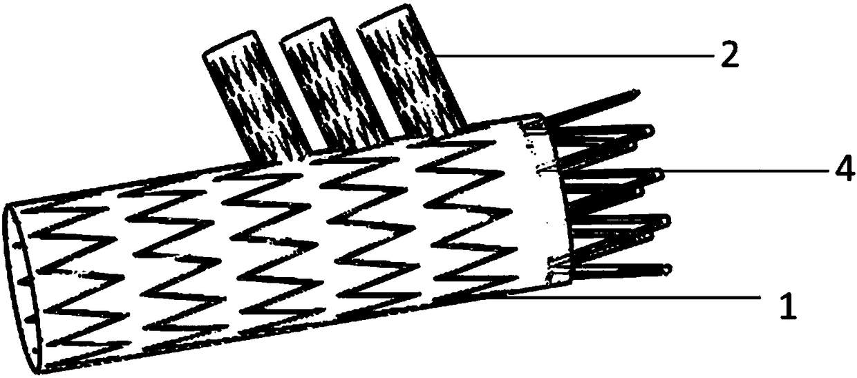 Integrated covered branch vessel stent and its delivery system