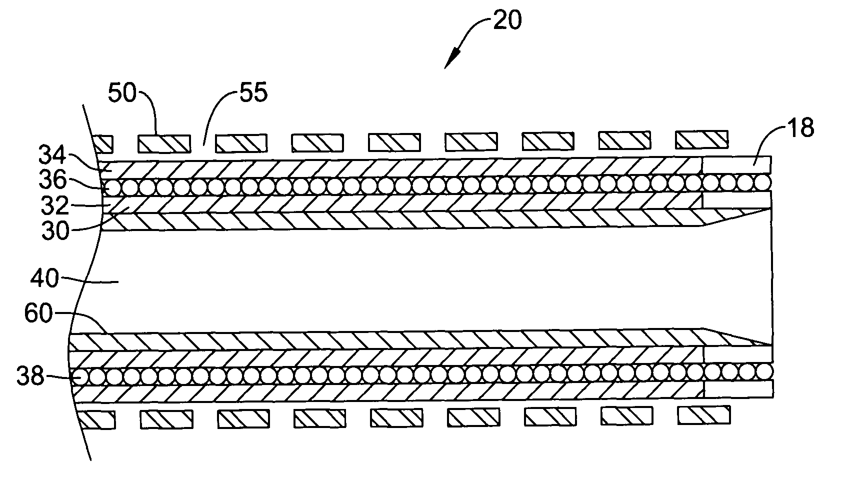 Selectively flexible catheter and method of use