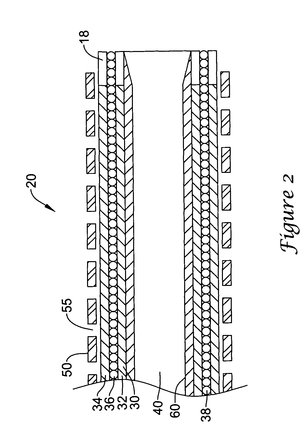 Selectively flexible catheter and method of use