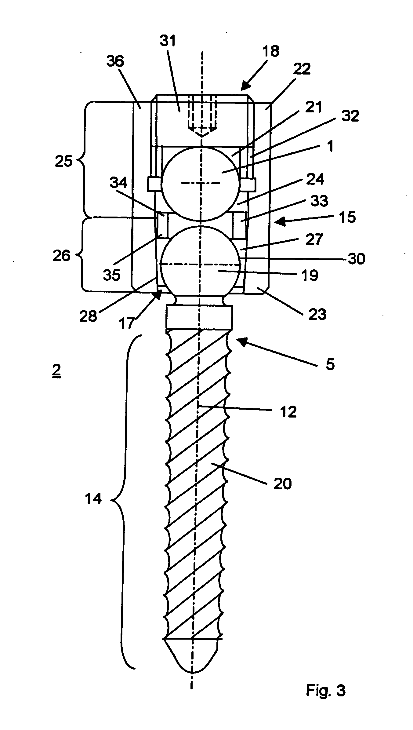 Device for the dynamic stabilization of bones