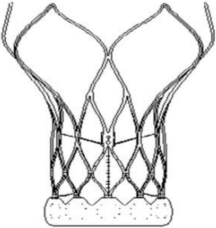 Method for manufacturing aortic intervention valve