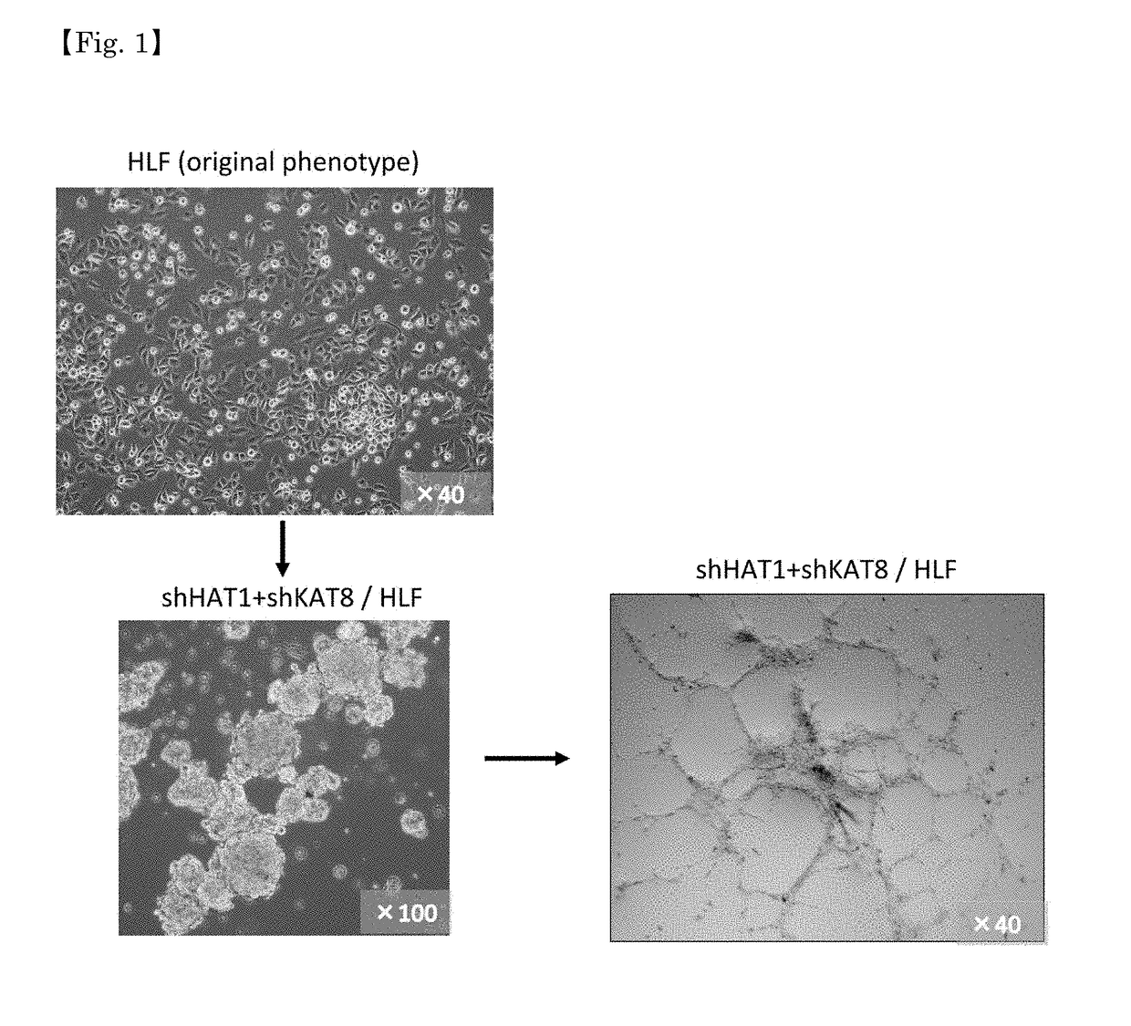 Inhibitors for methylation-related enzymes hat1 and kat8