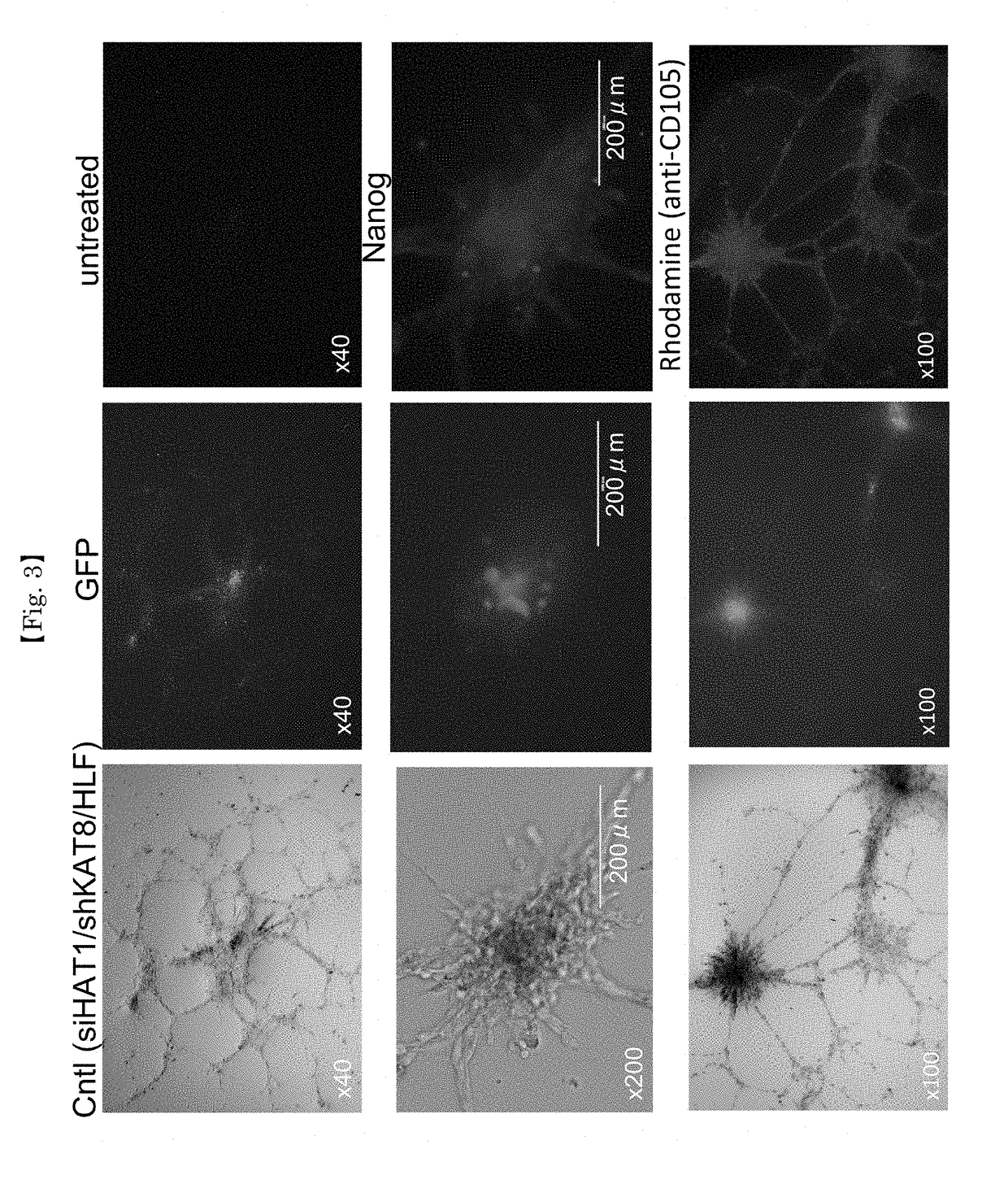 Inhibitors for methylation-related enzymes hat1 and kat8