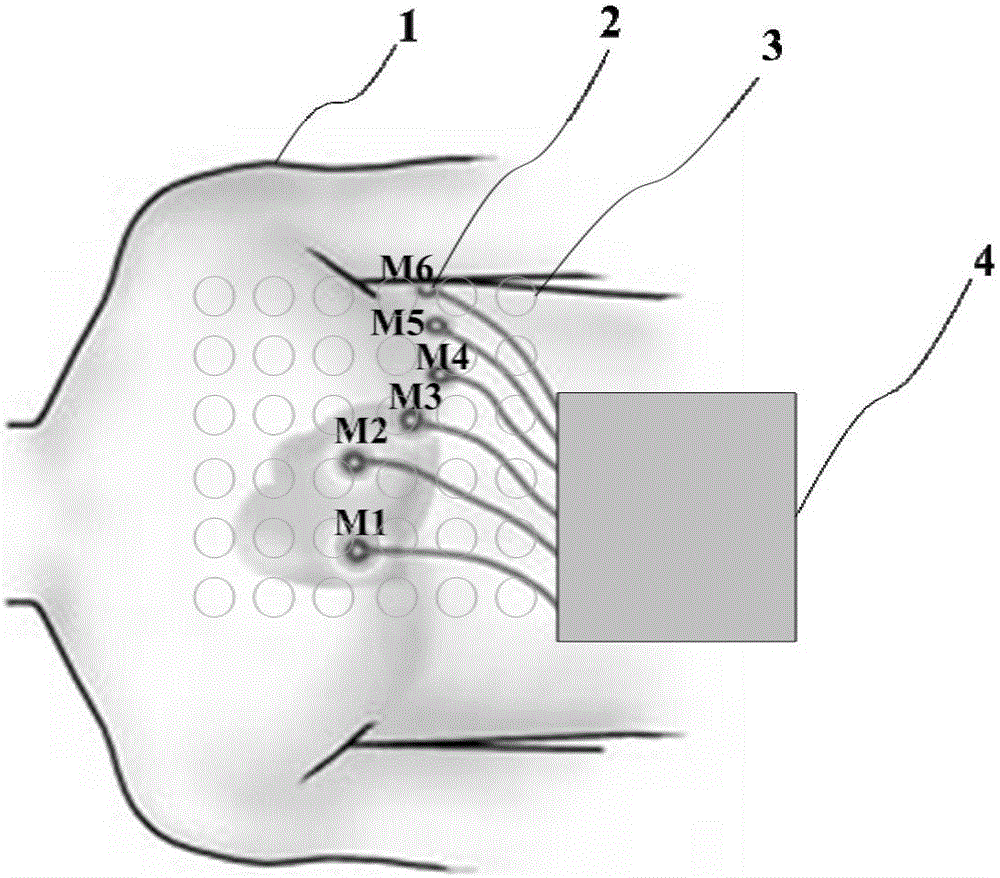 Auxiliary positioning method, system and equipment for current source of magnetocardiography