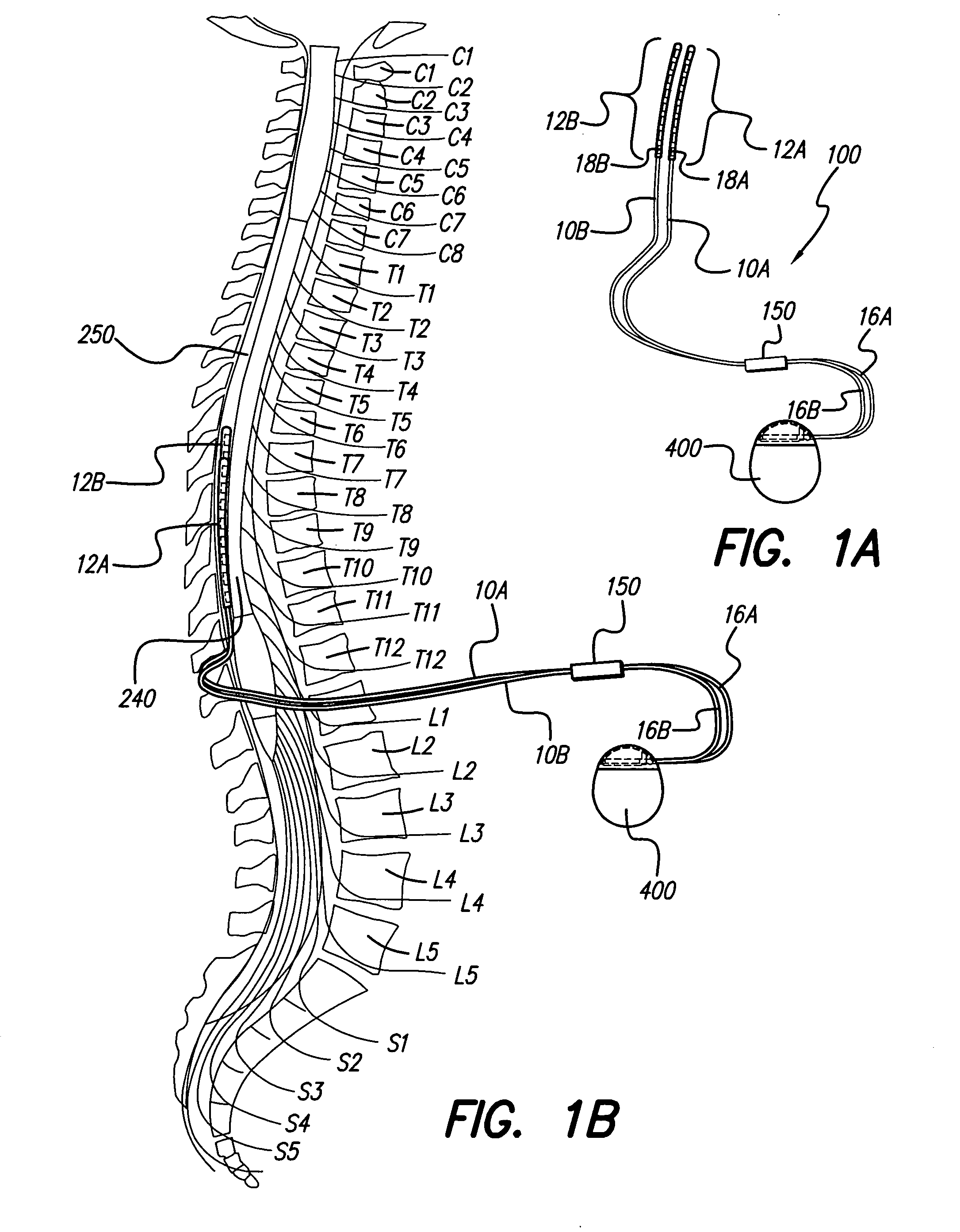 Operating room lead connector