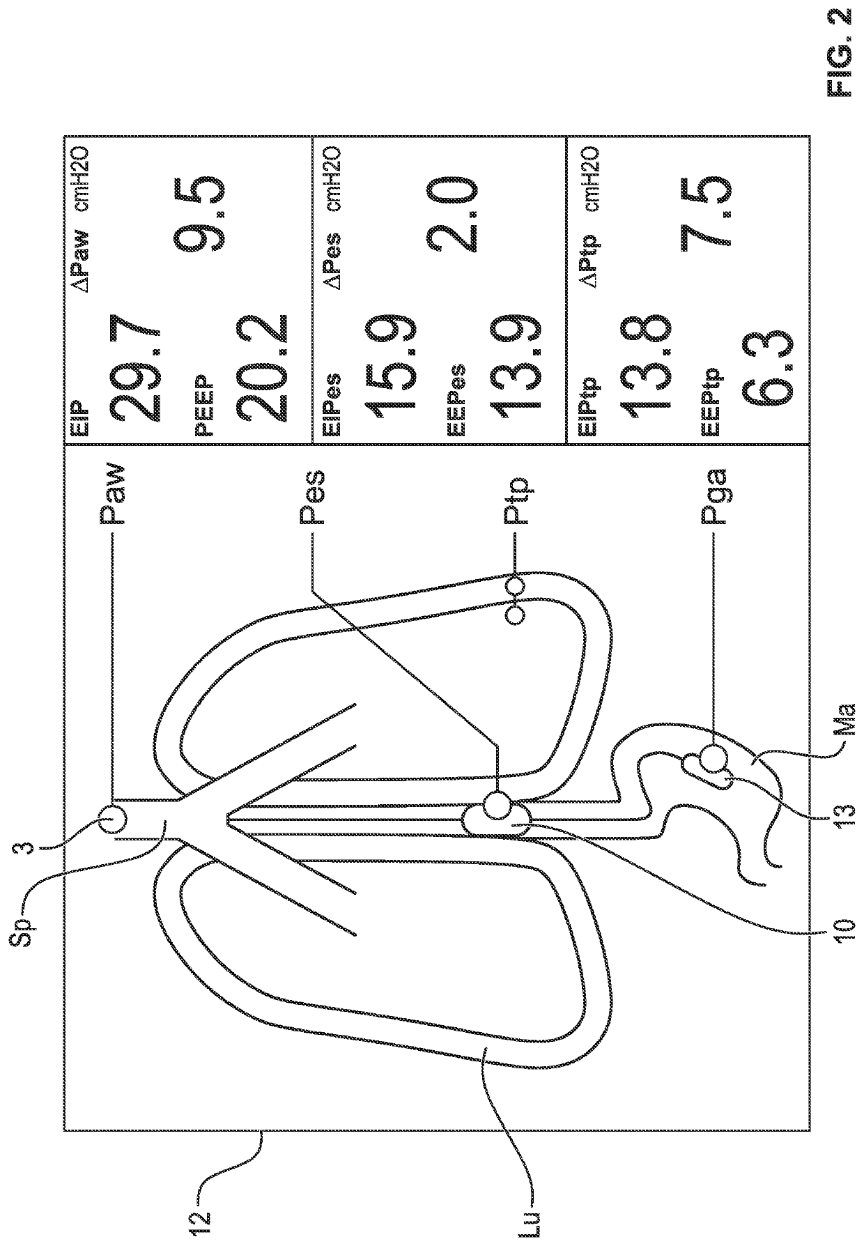 Device and process for measuring the lung compliance