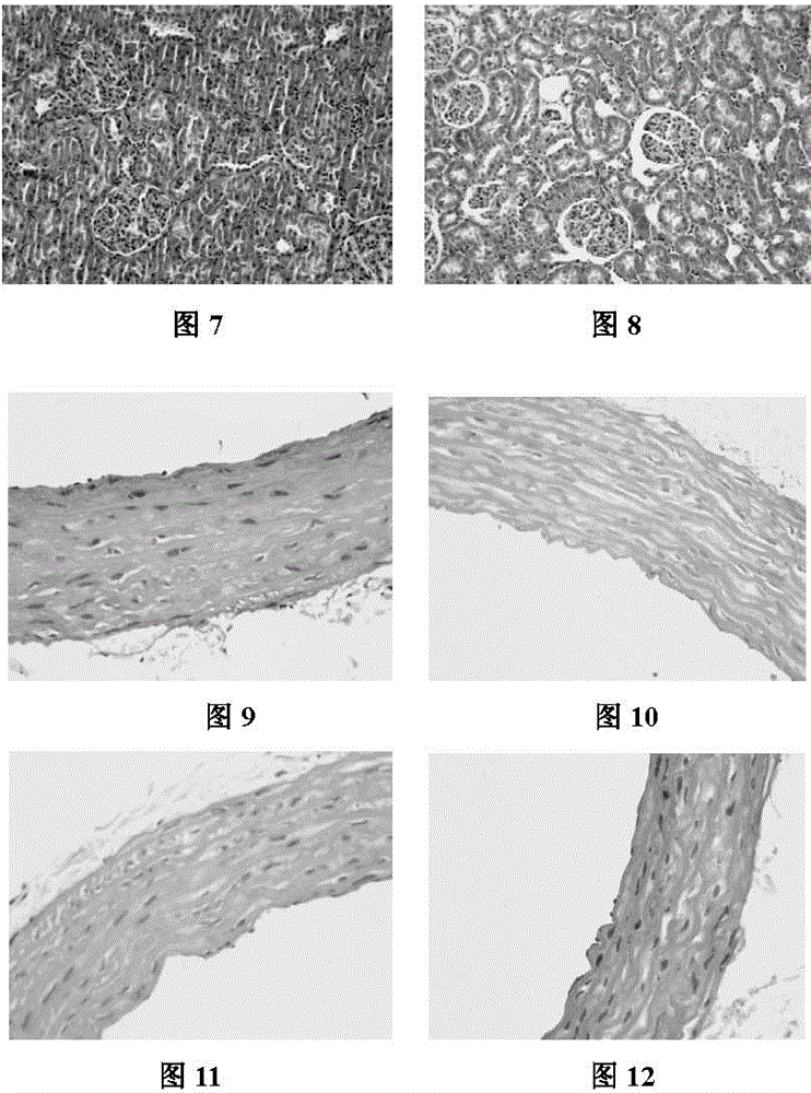 Extract for reducing blood pressure and adjusting blood fat and its preparation method and use