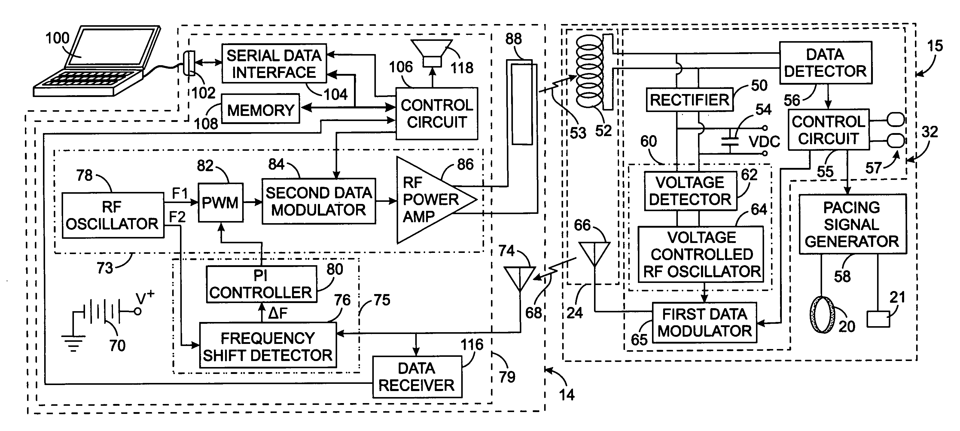 Extracorporeal power supply with a wireless feedback system for an implanted medical device