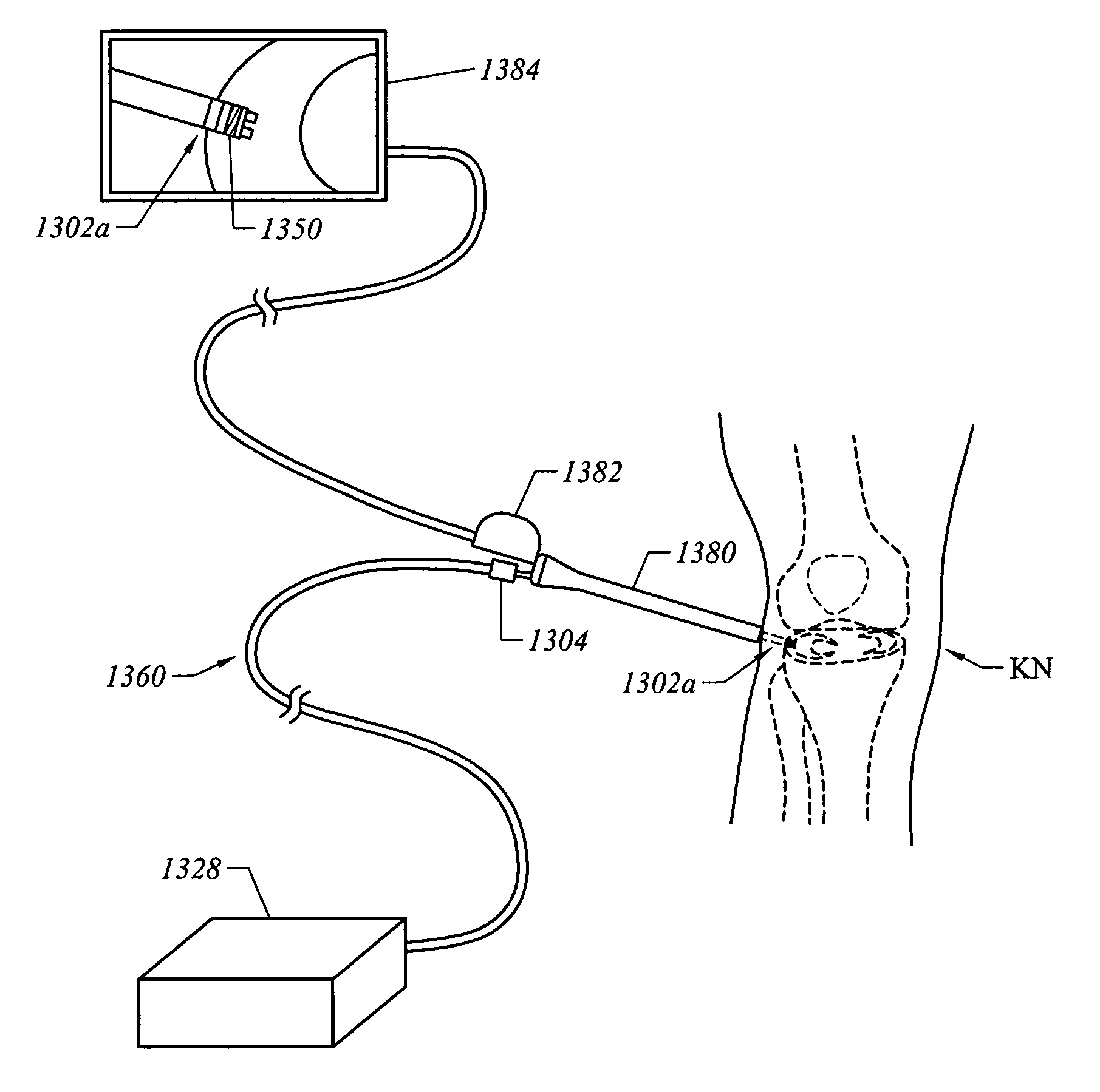 Temperature indicating electrosurgical apparatus and methods
