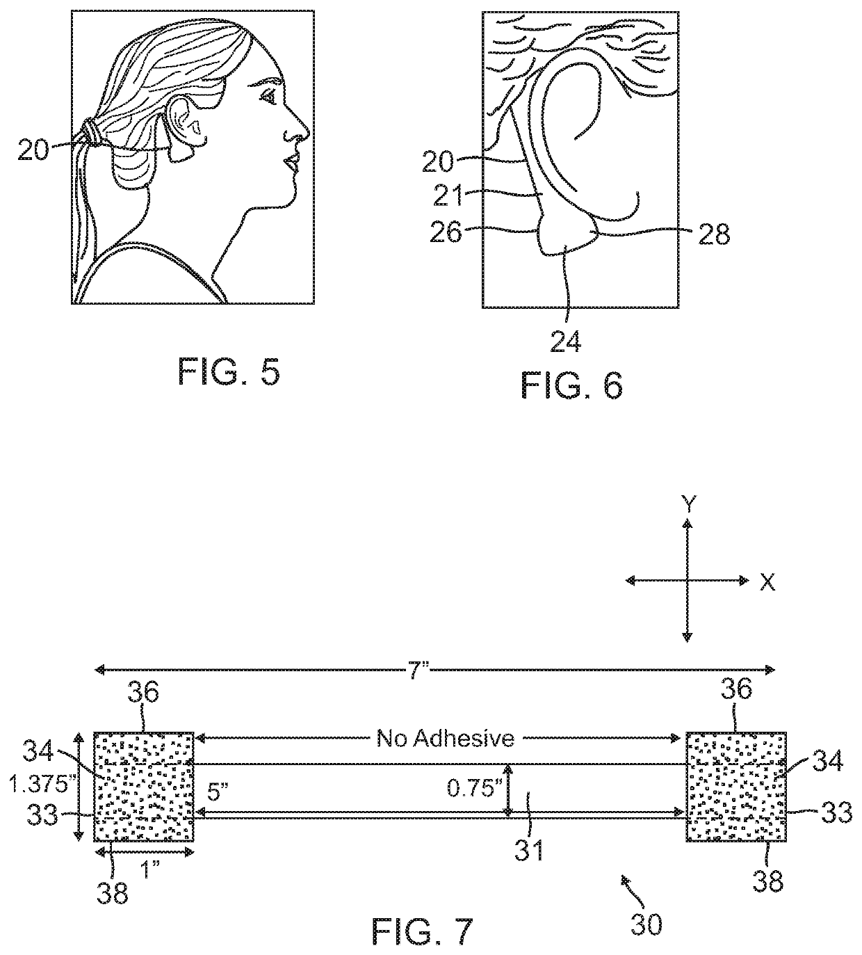 Noninvasive device and method for neck lift