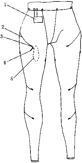 A remote-controlled wearable functional electrical stimulation device