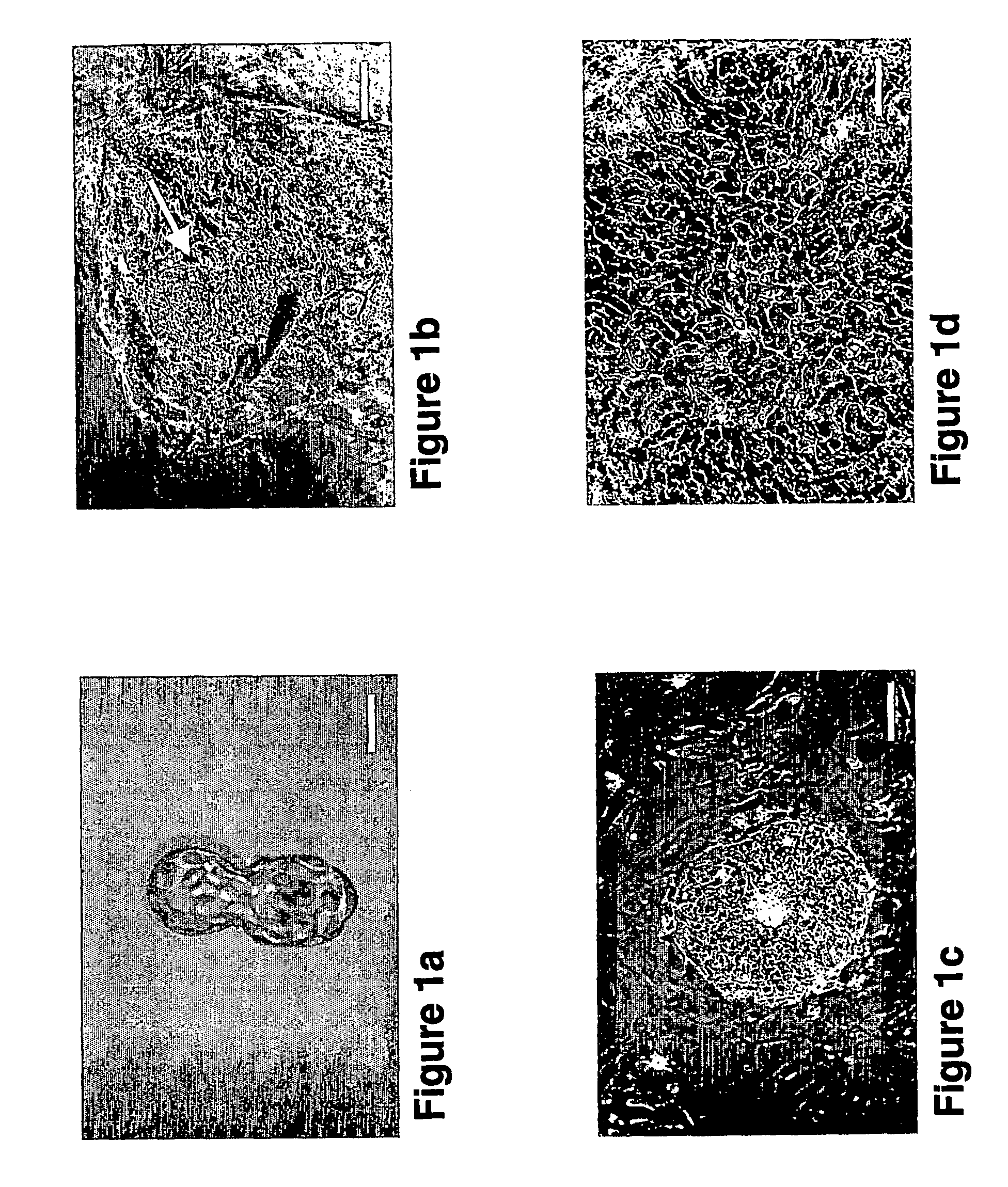 Methods of Generating Stem Cells and Embryonic Bodies Carrying Disease-Causing Mutations and Methods of Using same for Studying Genetic Disorders