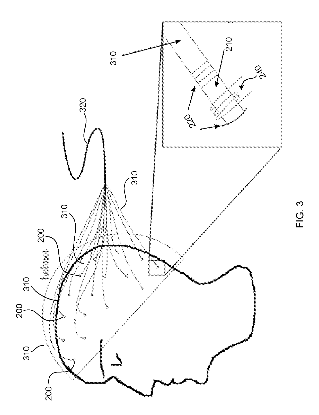 Magneto-encephalography device