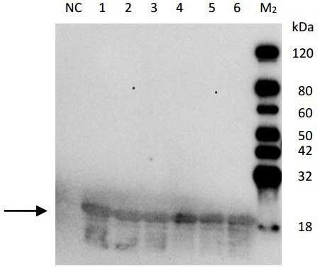 Talaromyces marneffei mannan protein and application of talaromyces marneffei mannan protein in preparation of talaromyces marneffei antibody detection kit