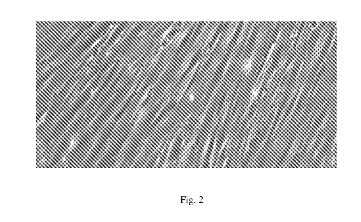 Compositions and methods for treating bone, joints and cartilage