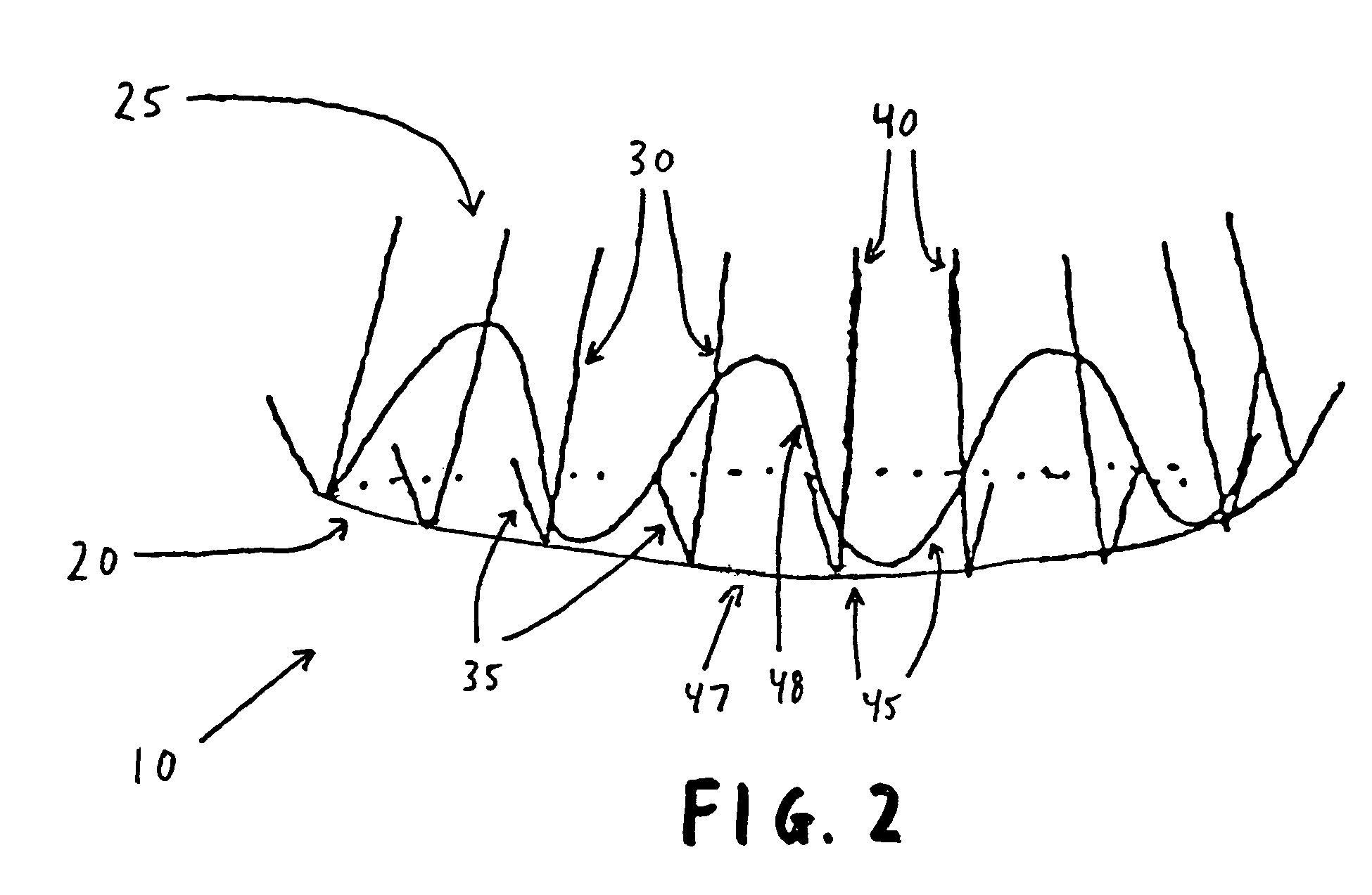 Fixation band for affixing a prosthetic heart valve to tissue