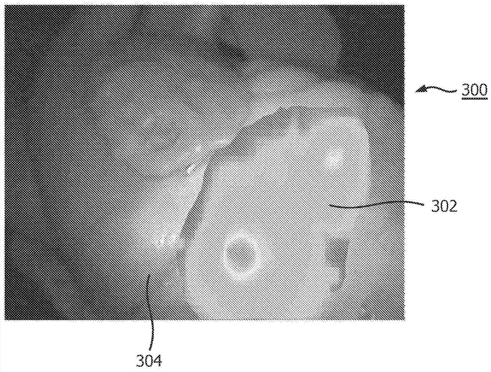 Assessment of patency using photoplethysmography on endoscopic images